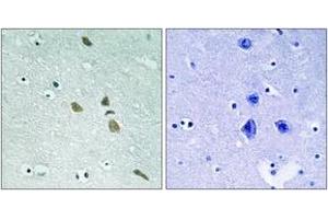 Immunohistochemistry analysis of paraffin-embedded human brain tissue, using ILK (Ab-246) Antibody.