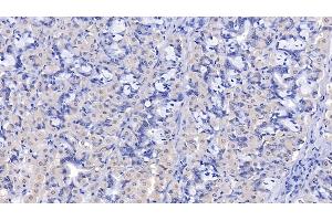 Detection of LSR in Human Stomach Tissue using Polyclonal Antibody to Lipolysis Stimulated Lipoprotein Receptor (LSR)