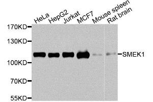 Western blot analysis of extracts of various cell lines, using SMEK1 antibody. (SMEK1 anticorps  (AA 395-594))