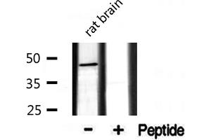 Western blot analysis of extracts from rat Brian, using CADM2 antibody. (CADM2 anticorps  (Internal Region))