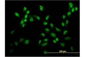 Immunofluorescence of monoclonal antibody to USF2 on HeLa cell.