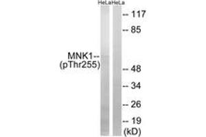 Western blot analysis of extracts from HeLa cells treated with Adriamycin 0. (MKNK1 anticorps  (pThr255))