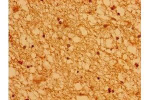 Immunohistochemistry of paraffin-embedded human brain tissue using ABIN7142982 at dilution of 1:100
