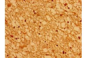 Immunohistochemistry of paraffin-embedded human brain tissue using ABIN7142982 at dilution of 1:100 (ASCL1 anticorps  (AA 1-236))