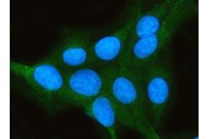 IF analysis of PPP2CA using anti-PPP2CA antibody (ABIN3043356). (PPP2CA anticorps  (AA 1-309))