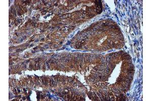 Image no. 11 for anti-Iduronate 2-Sulfatase (IDS) antibody (ABIN1498798)