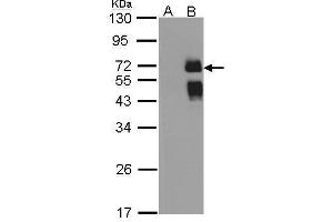 WB Image Western Blot analysis of ST6GAL1 expression in transfected 293T cell line by ST6GAL1 polyclonal antibody. (ST6GAL1 anticorps  (Center))