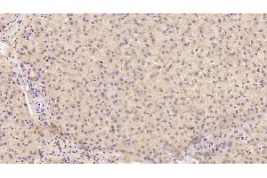 Detection of MANF in Human Liver Tissue using Monoclonal Antibody to Mesencephalic Astrocyte Derived Neurotrophic Factor (MANF) (MANF anticorps  (AA 28-182))