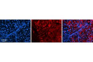 Rabbit Anti-STAT1 Antibody   Formalin Fixed Paraffin Embedded Tissue: Human Liver Tissue Observed Staining: Cytoplasm in hepatocytes Primary Antibody Concentration: 1:100 Other Working Concentrations: N/A Secondary Antibody: Donkey anti-Rabbit-Cy3 Secondary Antibody Concentration: 1:200 Magnification: 20X Exposure Time: 0.