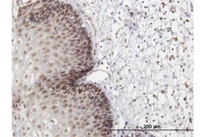 Immunoperoxidase of purified MaxPab antibody to LHX4 on formalin-fixed paraffin-embedded human esophagus.