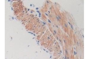 Detection of TOR1A in Mouse Stomach Tissue using Polyclonal Antibody to Torsin 1A (TOR1A)