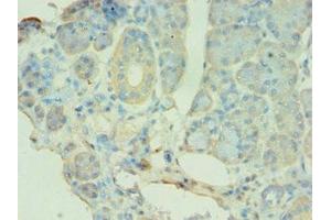 Immunohistochemistry of paraffin-embedded human pancreatic tissue using ABIN7145118 at dilution of 1:100 (ATG9B anticorps  (AA 715-924))