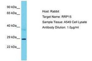 Image no. 1 for anti-Ribosomal RNA Processing 15 Homolog (RRP15) (AA 202-251) antibody (ABIN6750605) (RRP15 anticorps  (AA 202-251))