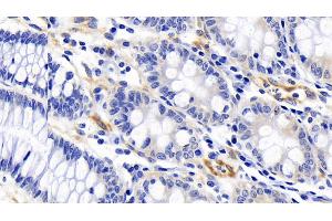 Detection of FAS in Human Colon Tissue using Polyclonal Antibody to Factor Related Apoptosis (FAS)
