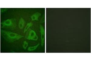 Immunofluorescence analysis of HeLa cells, using FAS (Ab-291) Antibody. (FAS anticorps  (AA 257-306))