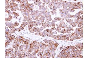 IHC-P Image Immunohistochemical analysis of paraffin-embedded OVCAR3 xenograft, using fumarate hydratase , antibody at 1:500 dilution. (FH anticorps)