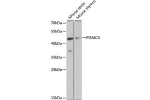 Western blot analysis of extracts of various cell lines, using PSMC3 antibody (ABIN3022704, ABIN3022705, ABIN3022706 and ABIN6219146) at 1:1000 dilution.