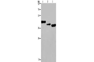 Western Blotting (WB) image for anti-Cysteine-Rich, Angiogenic Inducer, 61 (CYR61) antibody (ABIN2429877) (CYR61 anticorps)