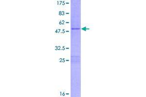 Image no. 1 for Regulator of G-Protein Signaling 2 (RGS2) (AA 1-211) protein (GST tag) (ABIN1317955)