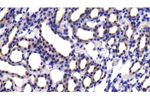 Detection of CASP9 in Rat Kidney Tissue using Polyclonal Antibody to Caspase 9 (CASP9)