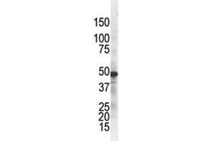 The IKK gamma antibody used in western blot to detect IKKg in ZR75-1 cell lysate.