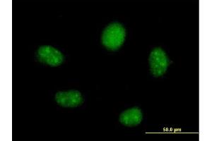 Immunofluorescence of  purified  MaxPab antibody to FTSJ2 on HeLa cell. (FTSJ2 anticorps  (AA 1-246))
