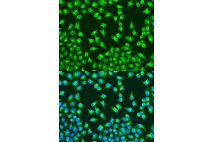 Immunofluorescence analysis of U2OS cells using MT-CO2 antibody (ABIN6294175) at dilution of 1:100. (COX2 anticorps)