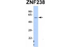 Host:  Rabbit  Target Name:  ZNF238  Sample Type:  Human Fetal Stomach  Antibody Dilution:  1.
