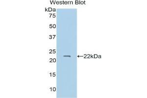Western blot analysis of the recombinant protein. (PROS1 anticorps  (AA 301-476))