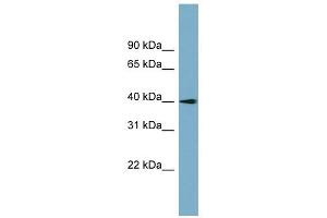 SLC25A22 antibody used at 1 ug/ml to detect target protein. (SLC25A22 anticorps)