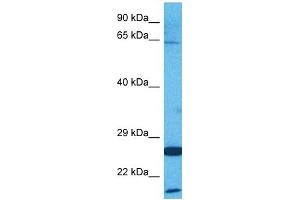 Host:  Rabbit  Target Name:  AMFR  Sample Tissue:  Human HepG2 Whole Cell  Antibody Dilution:  1ug/ml