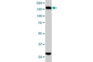 KIF15 monoclonal antibody (M01), clone 4D4 Western Blot analysis of KIF15 expression in HeLa .