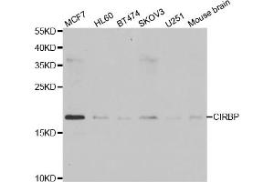 Western blot analysis of extracts of various cell lines, using CIRBP antibody. (CIRBP anticorps)
