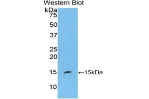 Detection of Recombinant S100A7, Mouse using Polyclonal Antibody to S100 Calcium Binding Protein A7 (S100A7) (S100A7 anticorps  (AA 1-108))