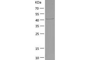 Western Blotting (WB) image for Fibrinogen gamma Chain (FGG) (AA 27-437) protein (His tag) (ABIN7122911)