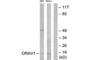 Western blot analysis of extracts from 293/HeLa cells, using ORAV1 Antibody. (ORAOV1 anticorps  (AA 81-130))