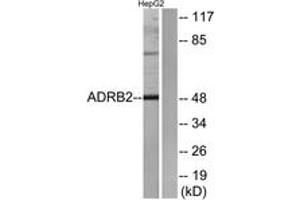 Western blot analysis of extracts from HepG2 cells, using ADRB2 Antibody. (beta 2 Adrenergic Receptor anticorps  (AA 336-385))