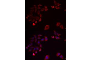 Immunofluorescence analysis of HeLa cells using SK antibody . (SKAP2 anticorps  (AA 1-120))