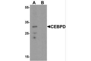 Western blot analysis of CEBPD in rat spleen tissue lysate with CEBPD Antibody  at 0. (CEBPD anticorps  (C-Term))
