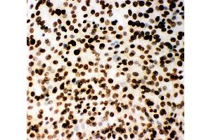 Anti-MCM2 antibody, ICC ICC: NIH3T3 Cell (MCM2 anticorps  (C-Term))