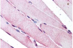Human Skeletal Muscle: Formalin-Fixed, Paraffin-Embedded (FFPE)