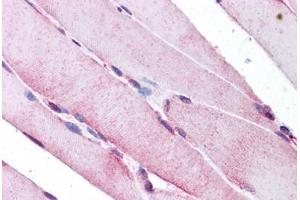 Human Skeletal Muscle: Formalin-Fixed, Paraffin-Embedded (FFPE) (SEPN1 anticorps  (C-Term))