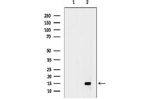 anti-Chemokine (C-C Motif) Ligand 16 (CCL16) (N-Term) antibody