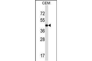 Western blot analysis in CEM cell line lysates (35ug/lane). (ACTG2 anticorps  (C-Term))