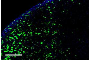 Immunohistochemistry analysis using Mouse Anti-Hexanoyl-Lysine adduct Monoclonal Antibody, Clone 5D9 (ABIN5067250). (Hexanoyl-Lysine Adduct (HEL) anticorps (PerCP))