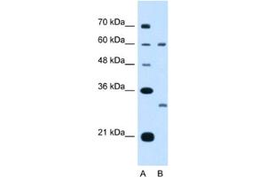 Western Blotting (WB) image for anti-Tetraspanin 32 (TSPAN32) antibody (ABIN2462993) (TSPAN32 anticorps)