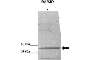 WB Suggested Anti-RAB3D Antibody    Positive Control:  Lane 1: BCAM0379 protein from B cenocepacia  Primary Antibody Dilution :   1:5000  Secondary Antibody :  Anti-rabbit-HRP   Secondry Antibody Dilution :   1:5000  Submitted by:  Katie Nurse (RAB3D anticorps  (C-Term))
