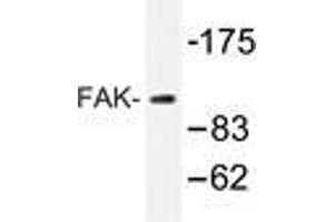 Western blot analysis of FAK antibody in extracts from 293 cells. (FAK anticorps)