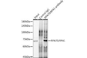 Immunoprecipitation analysis of 300 μg extracts of HeLa cells using 3 μg RP/RP antibody (ABIN7269915). (RPA1 anticorps)