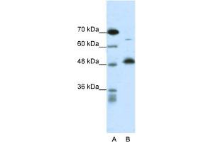 WB Suggested Anti-COPS2 Antibody   Titration: 0.